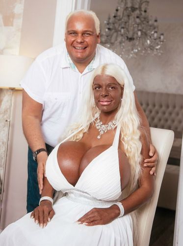 6. Martina Big, depois de alguns tantos procedimentos