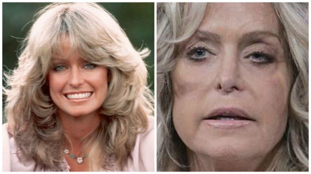 Farrah Fawcett